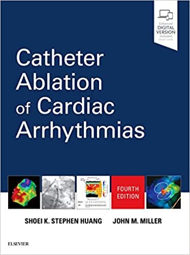 okumak Catheter Ablation of Cardiac Arrhythmias
