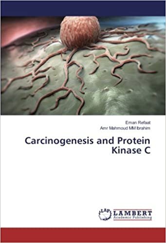 okumak Carcinogenesis and Protein Kinase C