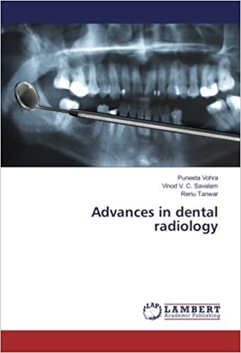 okumak Advances in dental radiology