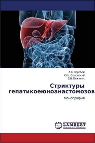 okumak Striktury gepatikoeyunoanastomozov: Monografiya