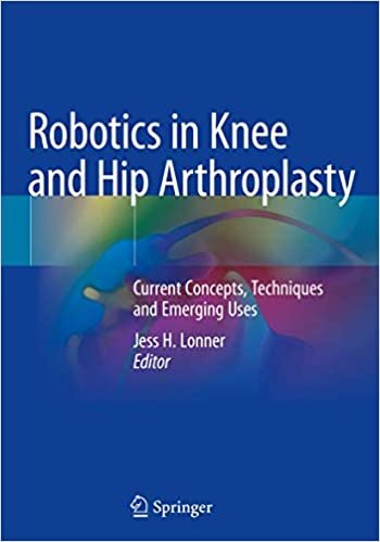 okumak Robotics in Knee and Hip Arthroplasty: Current Concepts, Techniques and Emerging Uses