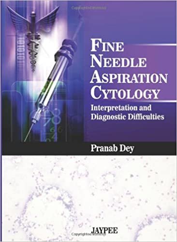 okumak Fine Needle Aspiration Cytology Interpretation and Diagnostic Difficulties