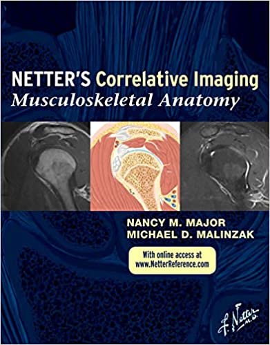 okumak Major, N: Netter&#39;s Correlative Imaging: Musculoskeletal Anat (Netter Clinical Science)