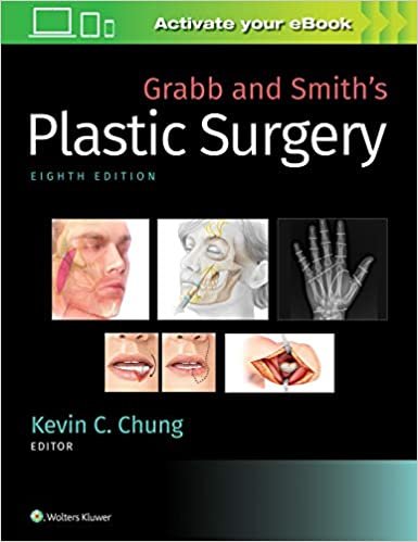 okumak Grabb and Smith&#39;s Plastic Surgery
