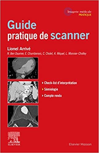 okumak Guide pratique de scanner (Imagerie médicale : pratique)