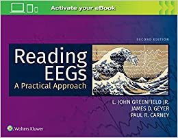 okumak Reading Eegs: A Practical Approach