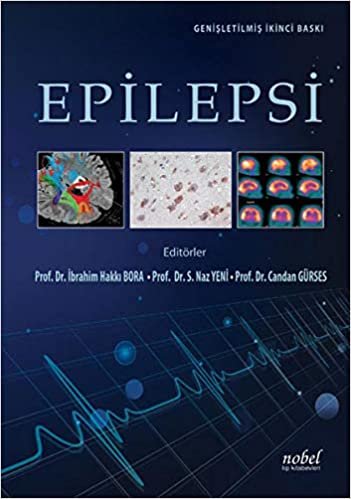 okumak Epilepsi