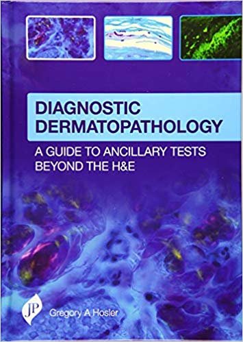okumak Diagnostic Dermatopathology: A Guide to Ancillary Tests Beyond the H&amp;E