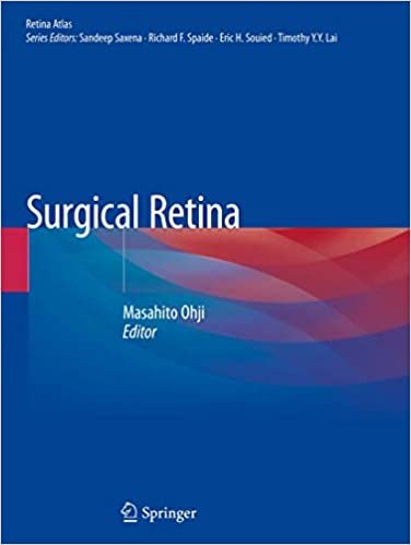 okumak Surgical Retina (Retina Atlas)