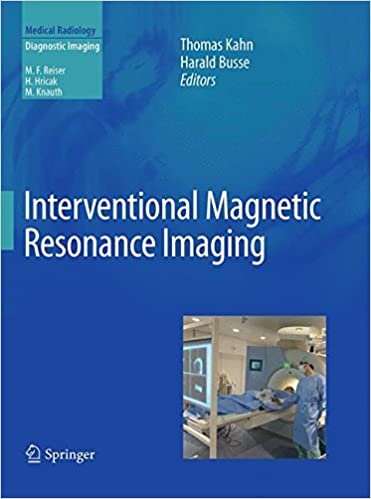 okumak Interventional Magnetic Resonance Imaging