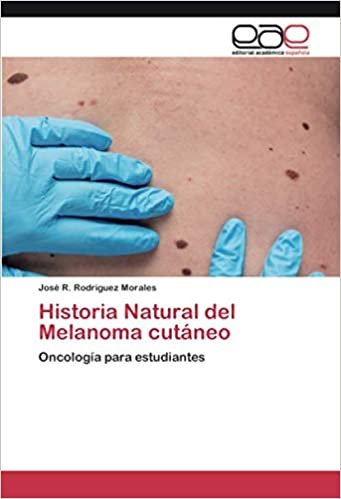 okumak Historia Natural del Melanoma cutáneo: Oncología para estudiantes