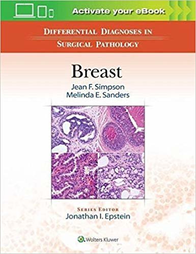 okumak Differential Diagnoses in Surgical Pathology: Breast