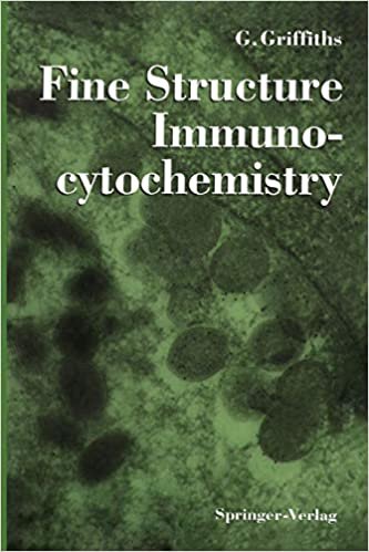 okumak Fine Structure Immunocytochemistry