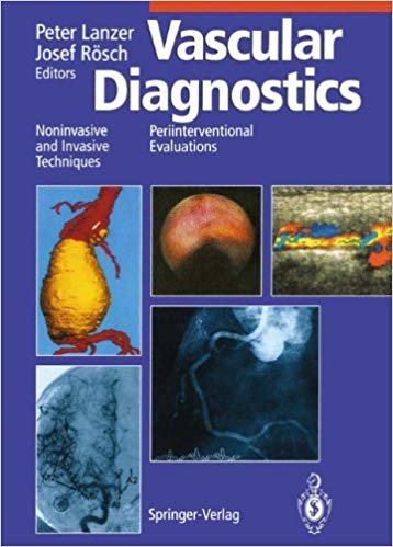 okumak Vascular Diagnostics : Noninvasive and Invasive Techniques Periinterventional Evaluations