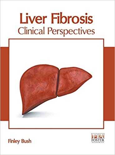 okumak Liver Fibrosis: Clinical Perspectives