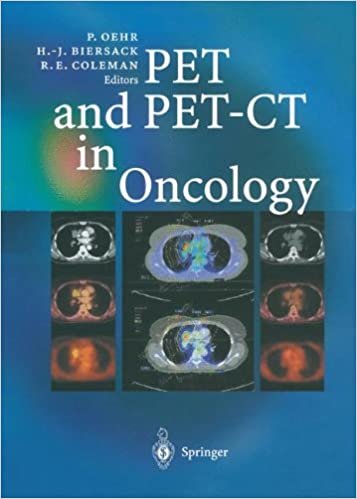 okumak PET and PET-CT in Oncology