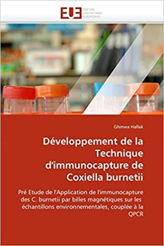 okumak Développement de la Technique d&#39;immunocapture de Coxiella burnetii: Pré Etude de l&#39;Application de l&#39;immunocapture  des C. burnetii par billes ... couplée à la QPCR (Omn.Univ.Europ.)