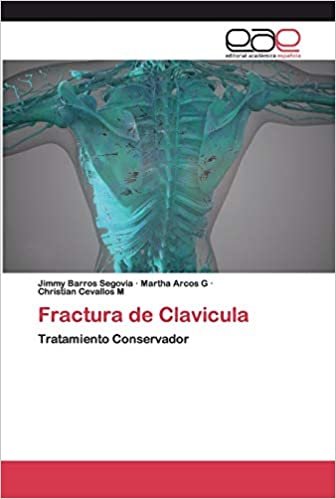 okumak Fractura de Clavicula: Tratamiento Conservador