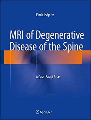 okumak MRI of Degenerative Disease of the Spine: A Case-Based Atlas