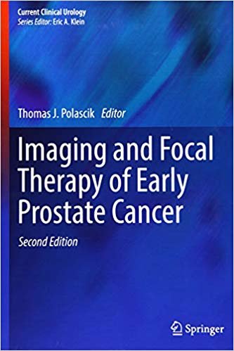 okumak Imaging and Focal Therapy of Early Prostate Cancer