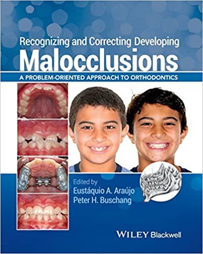 Recognizing and Correcting Developing Malocclusions: A Problem-Oriented Approach to Orthodontics indir