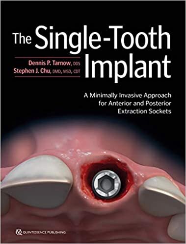 The Single-Tooth Implant: A Minimally Invasive Approach for Anterior and Posterior Extraction Sockets indir