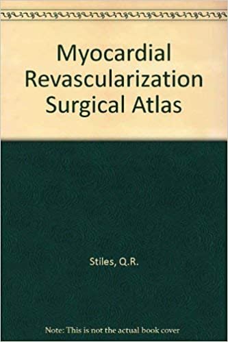Myocardial Revascularization Surgical Atlas