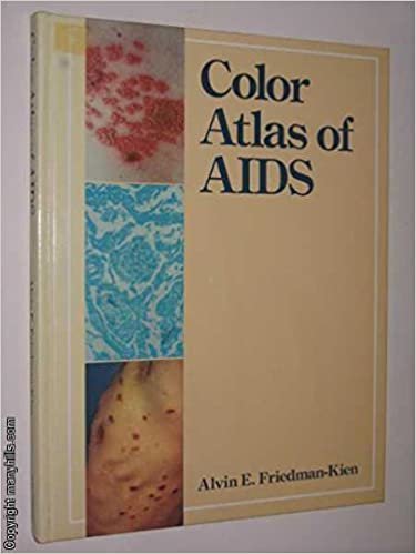 Color Atlas of AIDS indir