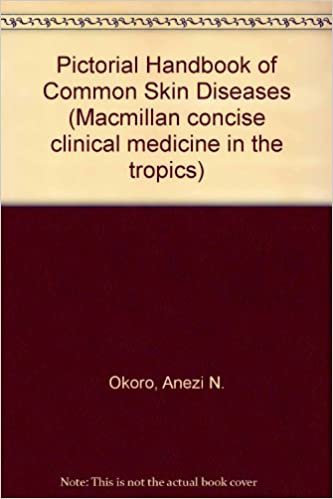 Pictorial Handbook Of Common Skin Diseases (Macmillan concise clinical medicine in the tropics) indir