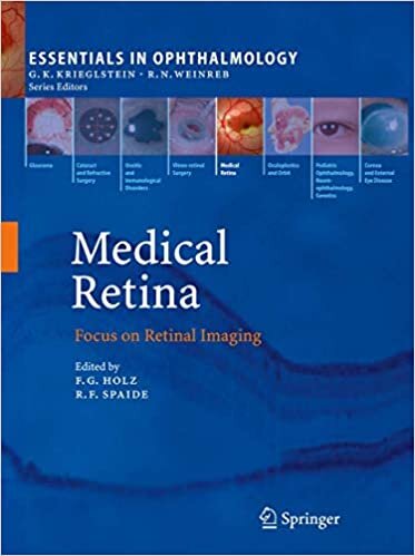 Medical Retina: Focus on Retinal Imaging (Essentials in Ophthalmology) indir