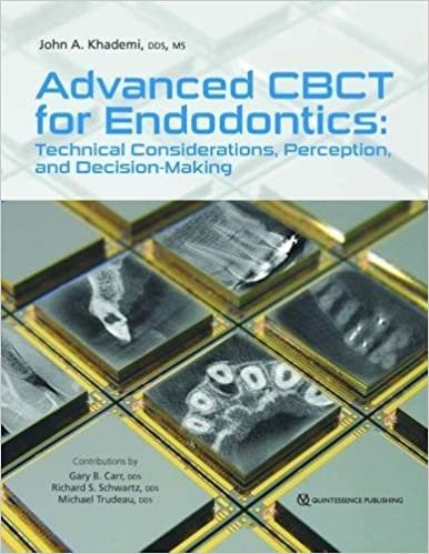 Advanced Cbct for Endodontics: Technical Considerations, Perception, and Decision-Making
