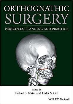 Orthognathic Surgery: Principles, Planning and Practice indir