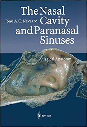 The Nasal Cavity and Paranasal Sinuses: Surgical Anatomy indir