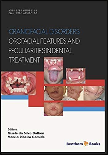 Craniofacial disorders – orofacial features and peculiarities in dental treatment