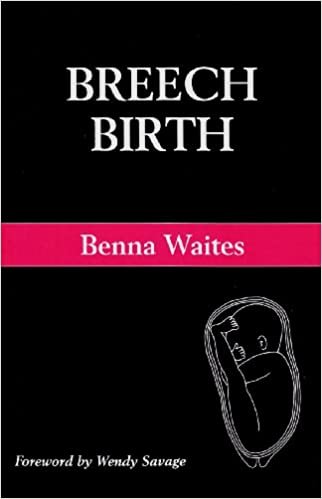 Breech Birth: A Guide to Breech Pregnancy and Birth