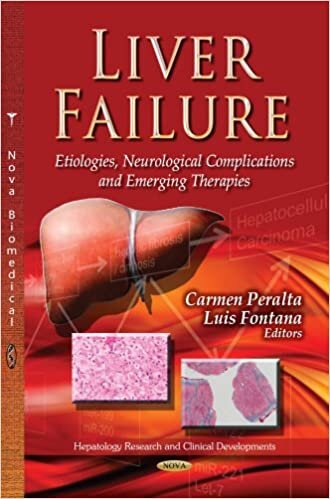 LIVER FAILURE (Hepatology Research and Clinical Developments)