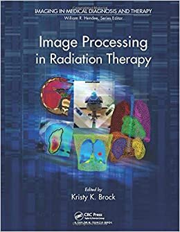 Image Processing in Radiation Therapy (Imaging in Medical Diagnosis and Therapy)