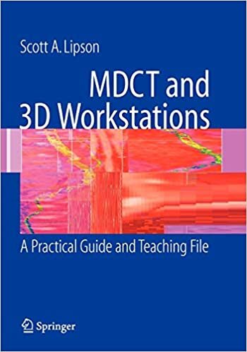 MDCT and 3D Workstations: A Practical How-To Guide and Teaching File indir