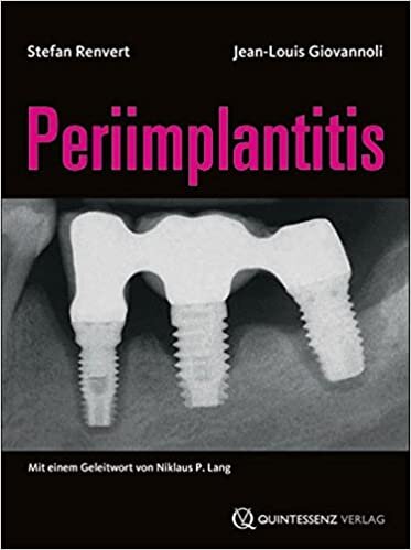 Periimplantitis