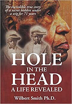 Hole in the Head: A Life Revealed