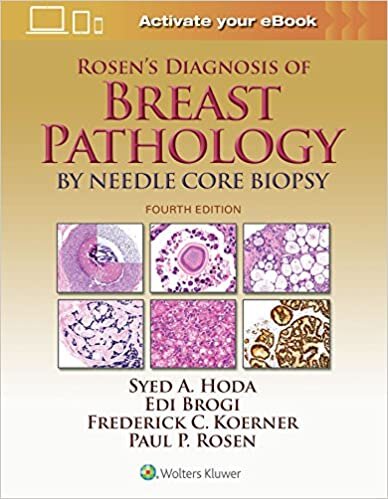 Hoda: Rosen's Diagnosis of Breast Pathology by Needle