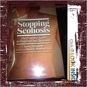 Stopping Scoliosis