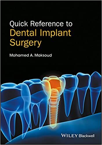 Quick Reference to Dental Implant Surgery