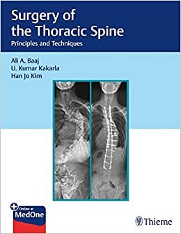 Surgery of the Thoracic Spine: Principles and Techniques indir