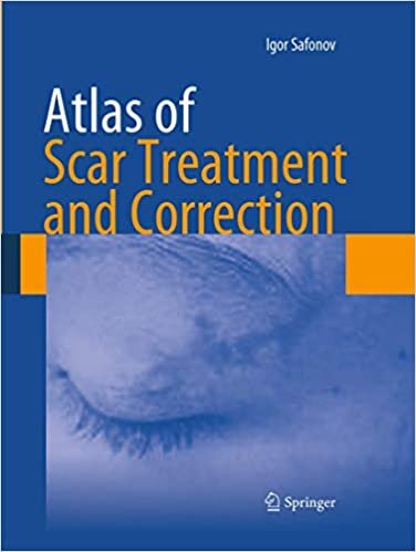 Atlas of Scar Treatment and Correction