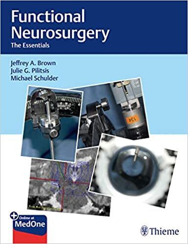 Functional Neurosurgery: The Essentials indir