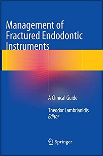 Management of Fractured Endodontic Instruments: A Clinical Guide