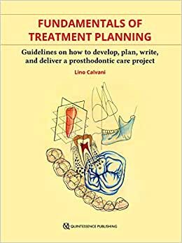 Fundamentals of Treatment Planning