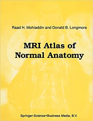 Atlas of Normal Anatomy Mri (Series in Radiology)