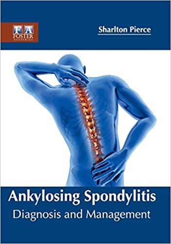 Ankylosing Spondylitis: Diagnosis and Management